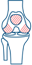 Chondromalacia Patella