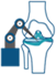 Mako Robotic-Arm Assisted Knee Replacement Surgery