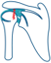 Rotator Cuff Tear