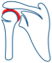 Shoulder Arthritis