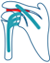 Shoulder Impingement