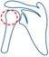 Shoulder Instability