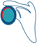 Shoulder Labral Tear